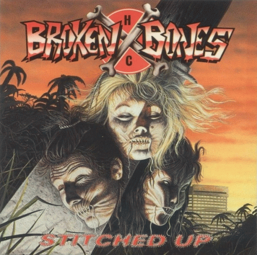 Broken Bones (UK) : Stitched Up